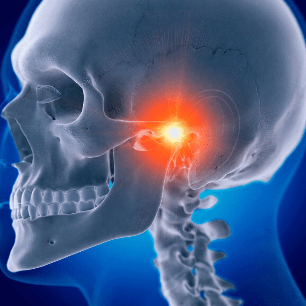 Mandíbula estalando e dor de cabeça estão entre sintomas da DTM