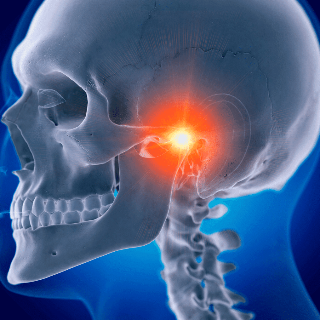 Uniodonto Votuporanga - Já teve a sensação de mandíbula travada? Ela também  pode ser um sinal da disfunção temporomandibular, a famosa DTM. A DTM é um  problema que acomete mais pessoas do